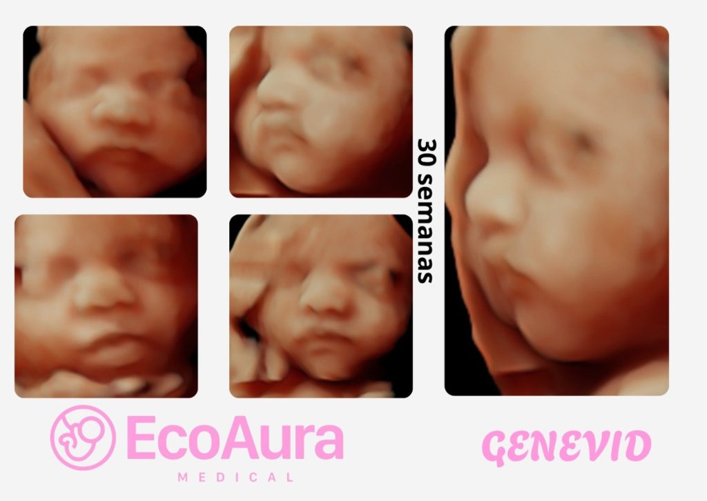 Ecografía de bebé a las 30 semanas de embarazo en Tenerife
