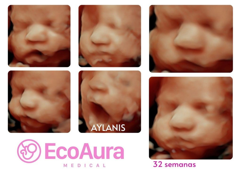 Ecografía de bebé a las 32 semanas de embarazo en Tenerife Sur